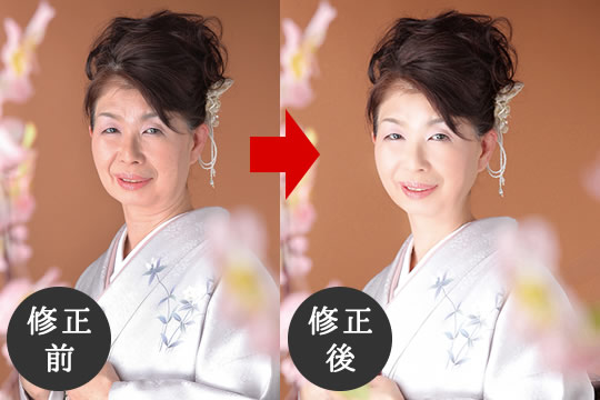 修正技術「フォトエステ」